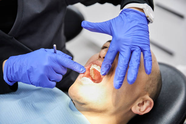 Best Dental Abscess Treatment in Cottage Grove, WI